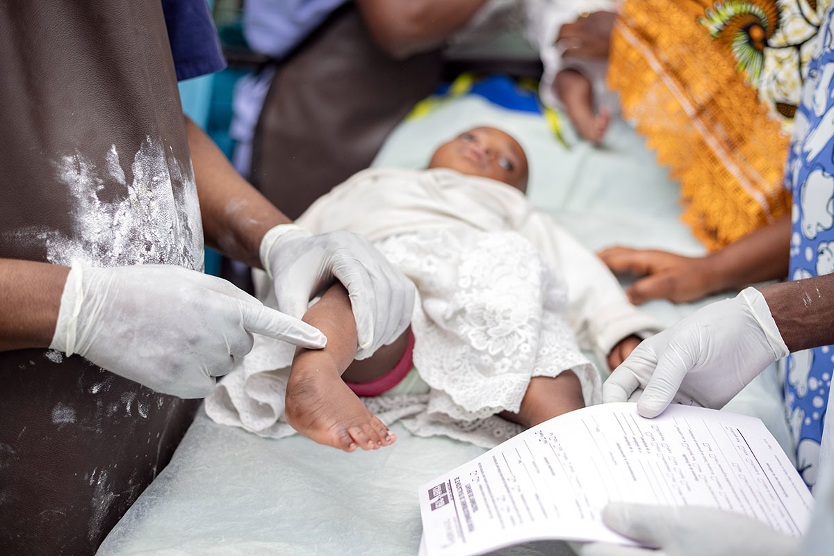 Prise en charge des pieds bots à HEAL Africa : Des soins gratuits pour corriger la malformation dès le plus jeune âge